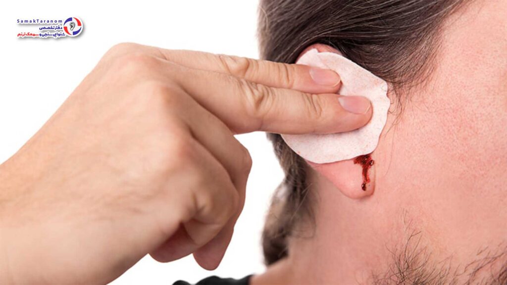 درمان آسیب های گوش