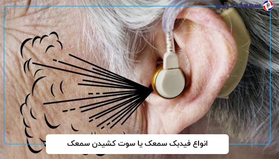 انواع فیدبک سمعک یا سوت کشیدن سمعک